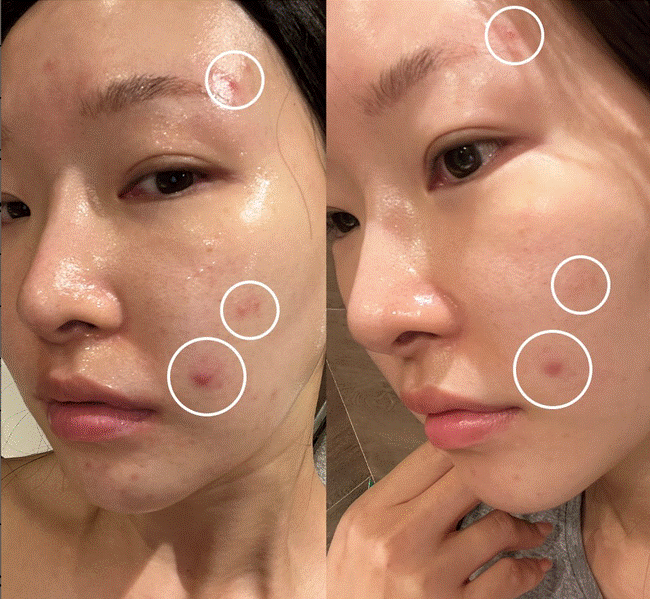 Chiêu dưỡng da 0 đồng mà các mẹ bỉm đều tín nhiệm, liệu có hiệu quả 100%-2