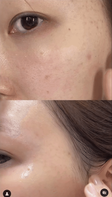 Chiêu dưỡng da 0 đồng mà các mẹ bỉm đều tín nhiệm, liệu có hiệu quả 100%-4