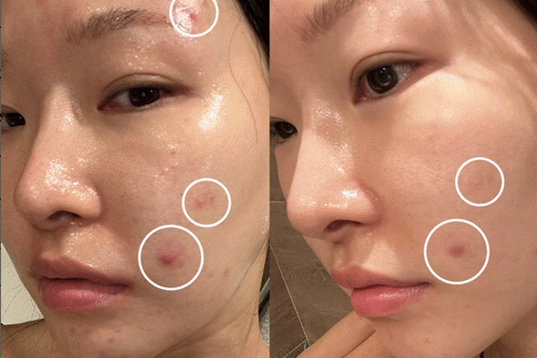 4 lưu ý dùng toner để phát huy tối đa hiệu quả dưỡng da trong mùa hanh khô-2