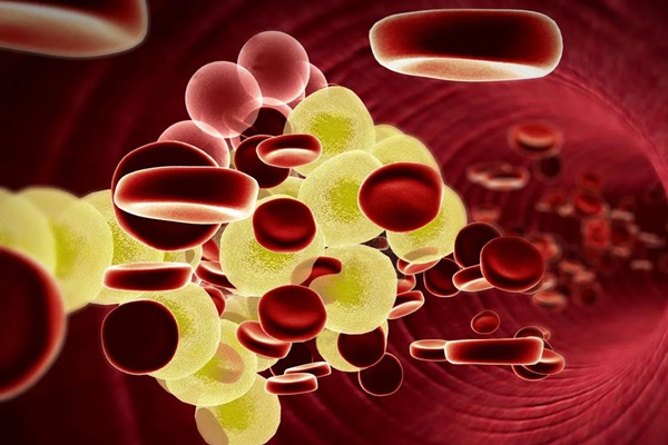 Không ăn đồ dầu mỡ nhưng mỡ máu vẫn sẽ tăng cao nếu sở hữu” 5 yếu tố này-1