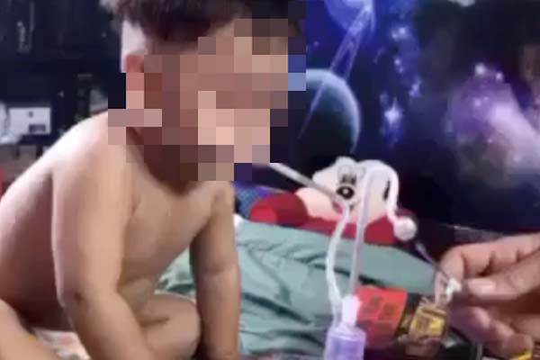 Đang chiên xôi, người phụ nữ ở Bình Dương ngã úp mặt vào chảo dầu tử vong-3