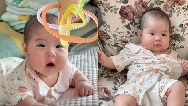 Em bé chào đời với vết bớt độc nhất vô nhị trên mặt, cư dân mạng đùa rằng: Bé trang điểm để gặp mẹ-1