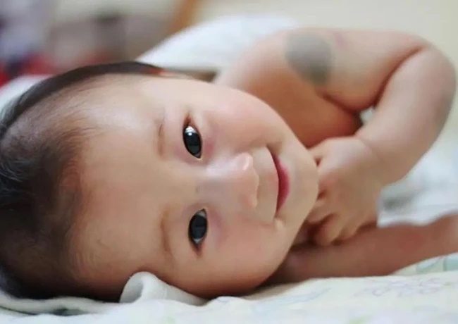 Em bé chào đời với vết bớt độc nhất vô nhị trên mặt, cư dân mạng đùa rằng: Bé trang điểm để gặp mẹ-3