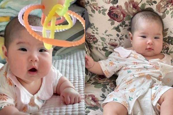 Bé gái có vết bớt hiếm gặp giữa trán, diện mạo hiện tại gây ngỡ ngàng-7