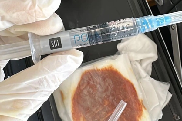 Hoại tử mi mắt vì spa tiêm ống oxy già tẩy trắng răng để làm đẹp-1