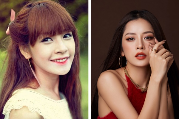 Chi Pu ngày càng quyến rũ sau một phẫu thuật, chuyên gia lưu ý trước khi làm cần nhớ kỹ 2 việc-3