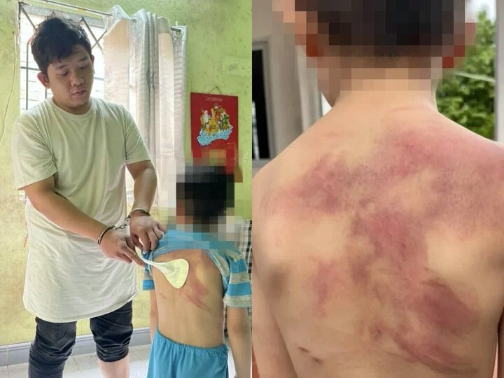 Bé trai 5 tuổi ở Đồng Nai bị cha ruột đánh dã man-1