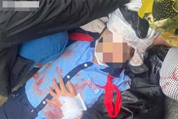 Nữ sinh lớp 6 bị gã thanh niên dùng búa đánh vào đầu vẫn đang liệt nửa người-1