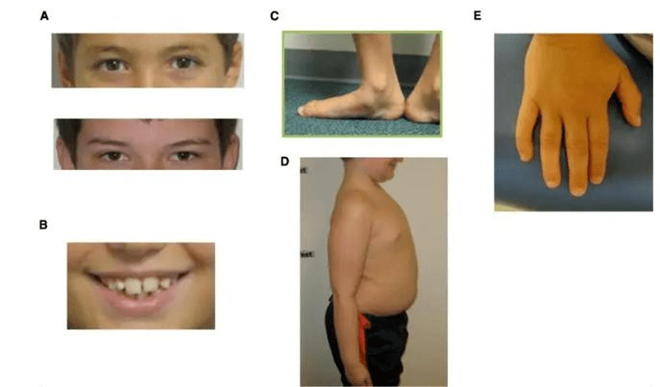 Con trai dậy thì bỗng nghịch ngợm hơn, mẹ đau lòng khi nghe bác sĩ kết luận mắc bệnh lạ-3