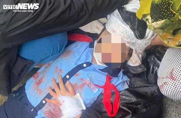 Nữ sinh lớp 6 bị gã thanh niên dùng búa đánh vào đầu: Thông tin mới nhất-1