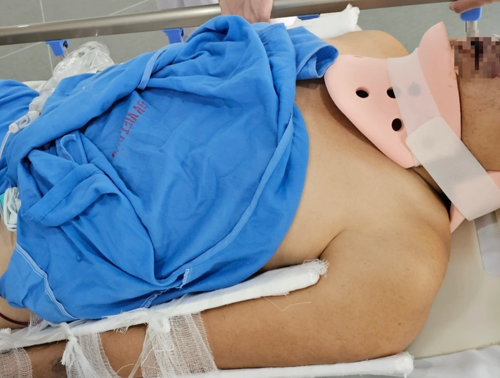 Vụ tai nạn 5 người chết: Tôi mở mắt ra thấy người bị thương nằm la liệt-3