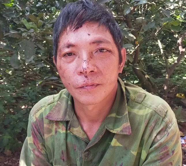 Chồng dùng điếu cày đánh chết vợ vì vợ không cho sử dụng điện thoại-1