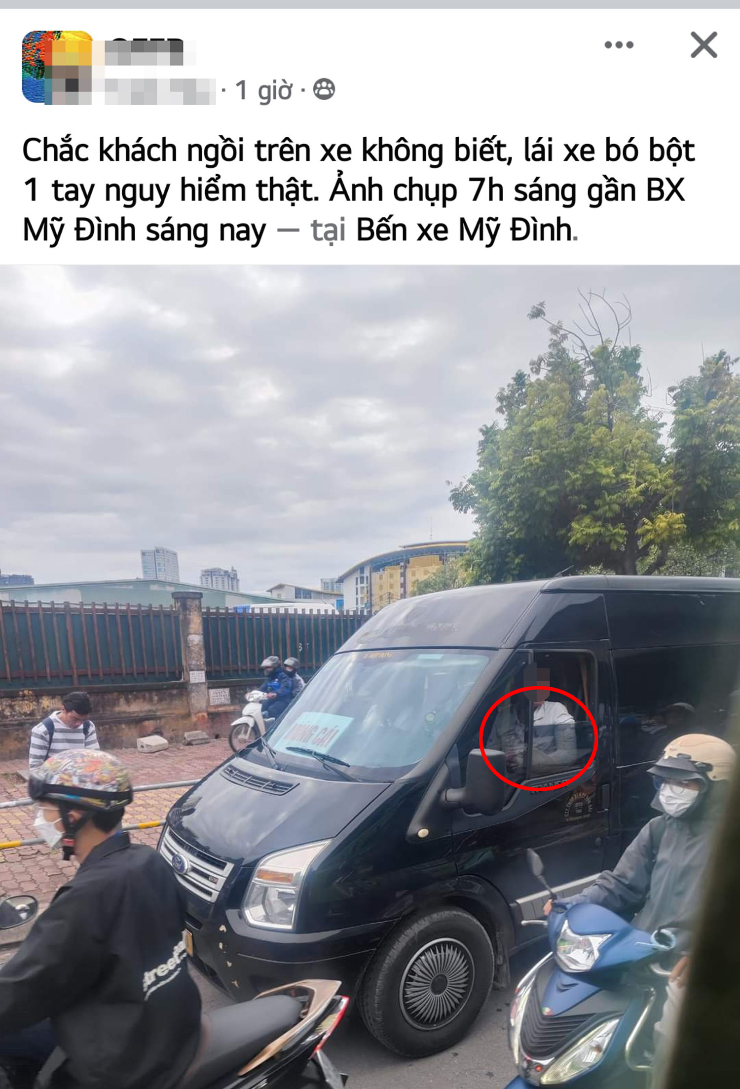 Xác minh vụ người đàn ông bó bột tay, lái xe Limousine ở Hà Nội-1