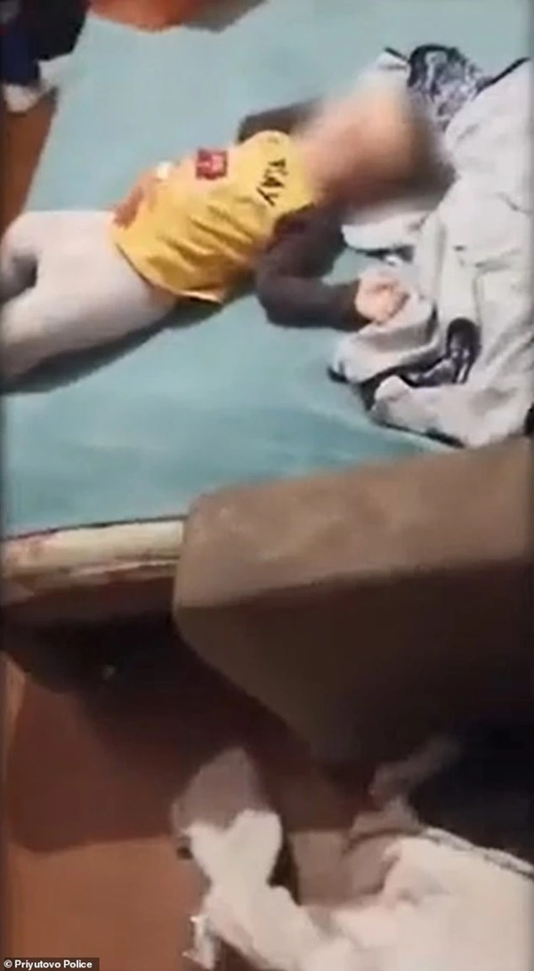 Tức vì chồng đùng đùng bỏ đi khi đang cãi vã, vợ trút giận lên con 18 tháng tuổi để lại cảnh tượng khiến nhân viên y tế ám ảnh-1