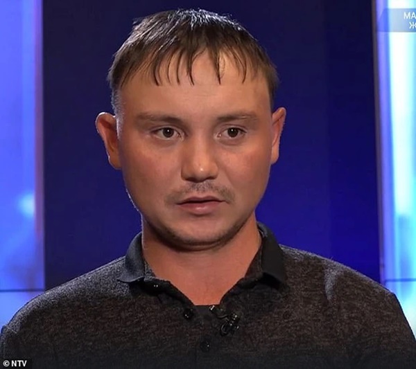 Tức vì chồng đùng đùng bỏ đi khi đang cãi vã, vợ trút giận lên con 18 tháng tuổi để lại cảnh tượng khiến nhân viên y tế ám ảnh-3