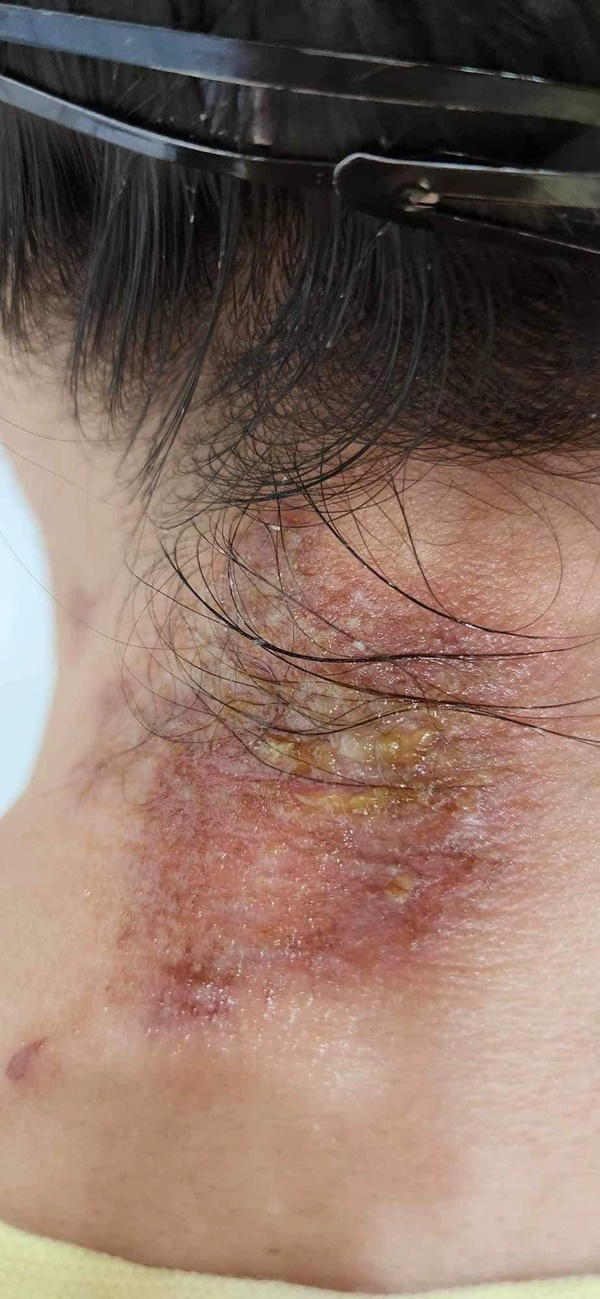 Chưa hết khổ vì muỗi, người Hà Nội lại bị kiến ba khoang hành-2