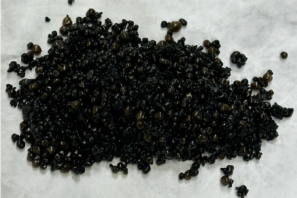 Nam thanh niên đau bụng dữ dội do túi mật chứa 3.200 viên sỏi-1