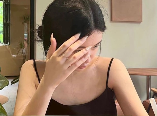 Gan khỏe hay không nhìn da là biết, thấy đỏ, đen, vàng” này phải đi khám ngay-2