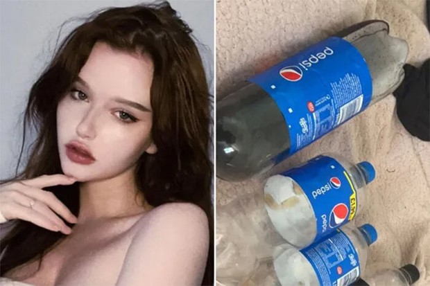 Cô gái nghiện Pepsi đến mức uống 4 lít/ngày, nếu không uống sẽ ốm nặng-1