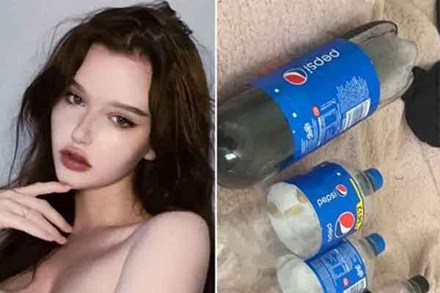 Cô gái nghiện Pepsi đến mức uống 4 lít/ngày, nếu không uống sẽ ốm nặng