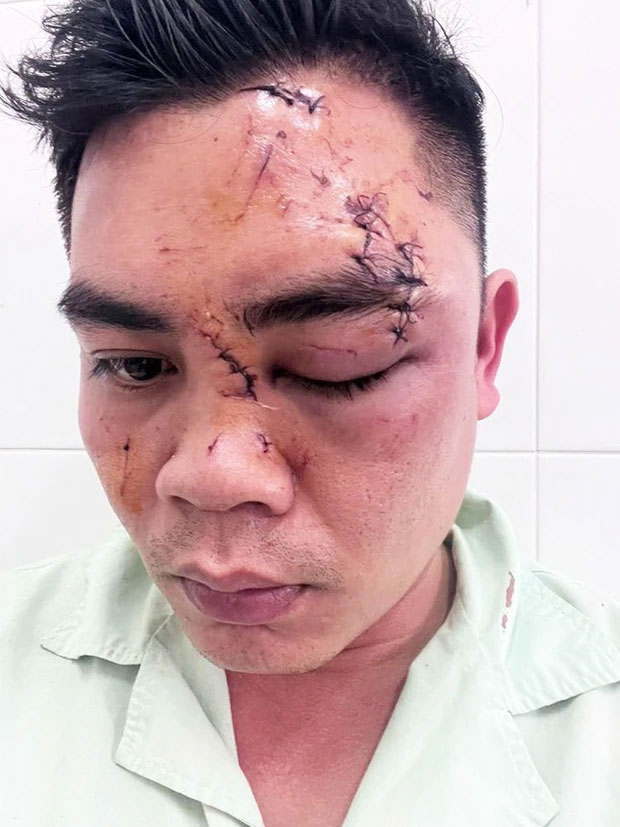 Ba cháu bé gào khóc, cầu cứu khi người cha bất ngờ bị đánh dã man tại nhà hàng-2