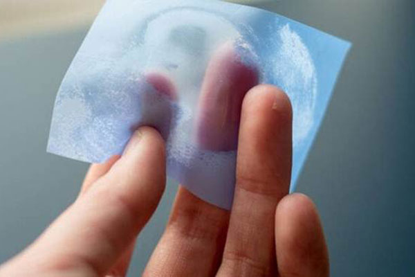 Da khô và da mất nước khác nhau thế nào?-3