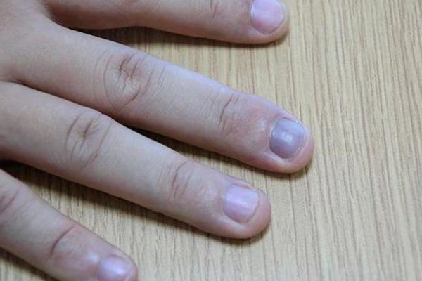 3 đen 2 hôi trên cơ thể cảnh báo gan có vấn đề, cảnh giác sớm không thừa-2