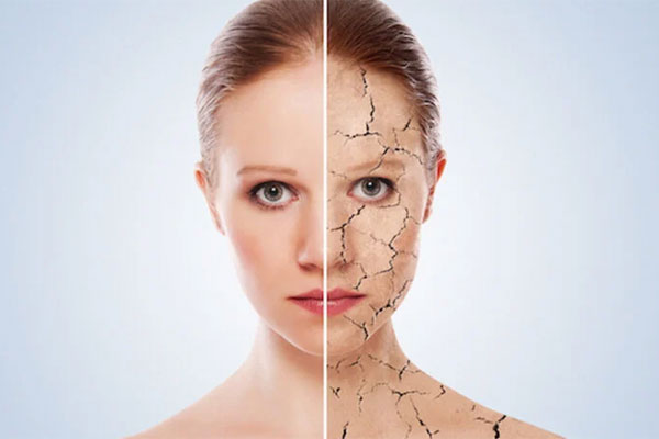 Da khô và da mất nước khác nhau thế nào?-1