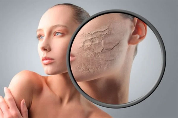 Da khô và da mất nước khác nhau thế nào?-2