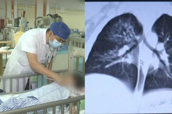 Bé trai 2 tuổi chứa hơn 10 loại vi khuẩn trong phổi, bác sĩ chỉ ra nơi là ổ mầm bệnh trong nhà nhưng ít người để ý lau dọn-1