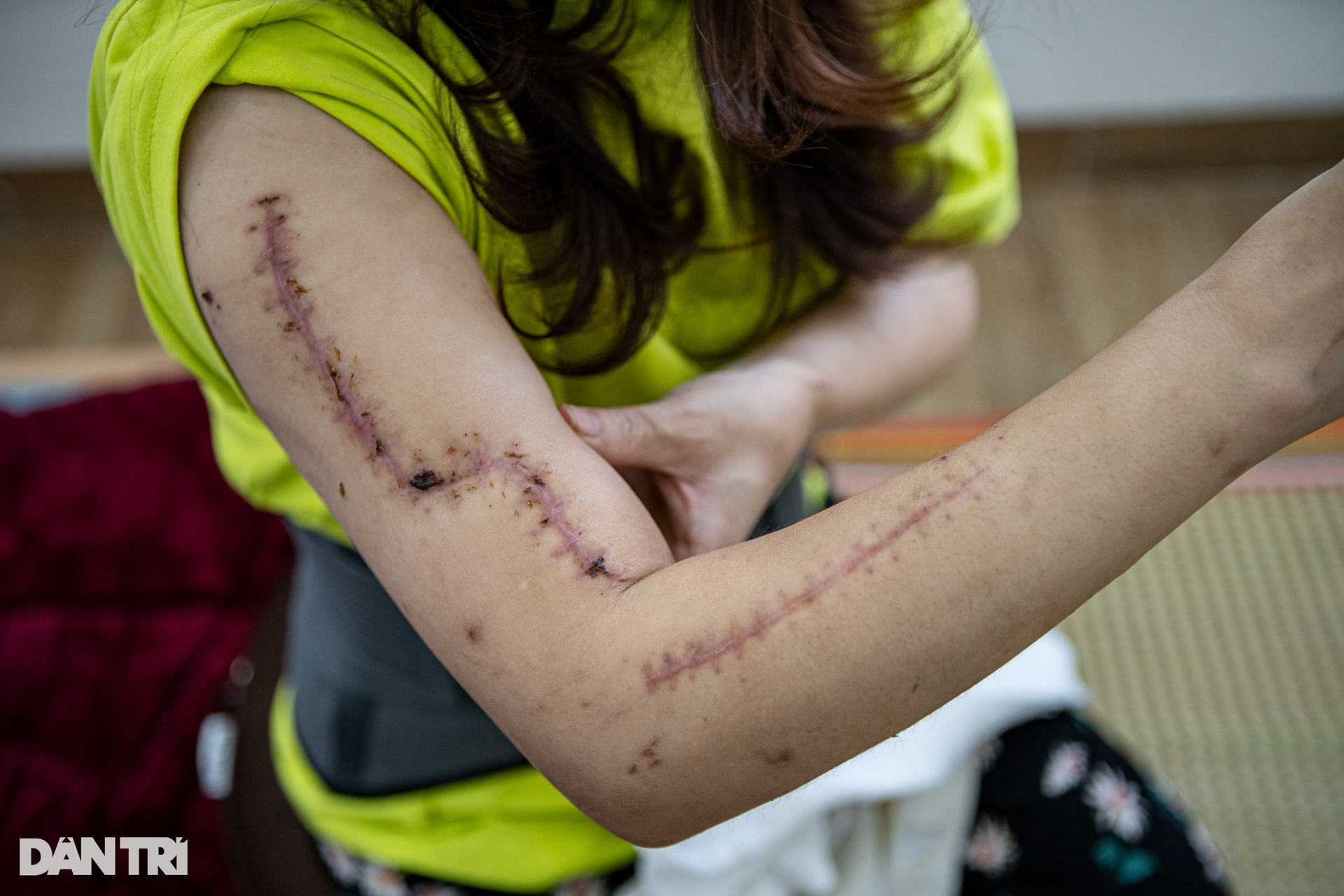 Cuộc sống trả nợ ân tình cuộc đời của các nạn nhân vụ cháy chung cư mini-8