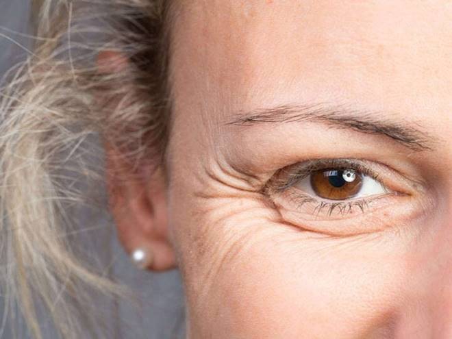 Cách chăm sóc vùng da mỏng dưới mắt-1