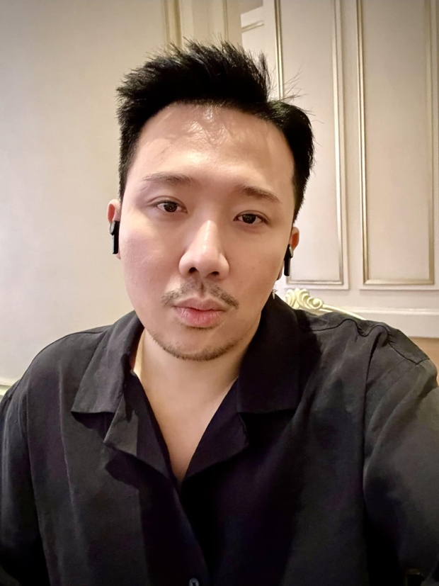 Trấn Thành đăng ảnh cận mặt, tiết lộ 1 điểm thay đổi giữa nghi vấn sang Hàn phẫu thuật thẩm mỹ?-1