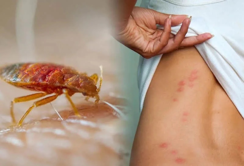 Cách phòng chống và diệt loài rệp giường-2