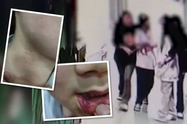 Người cha treo thưởng 34 triệu đồng cho ai tìm được kẻ đánh đập con mình-1