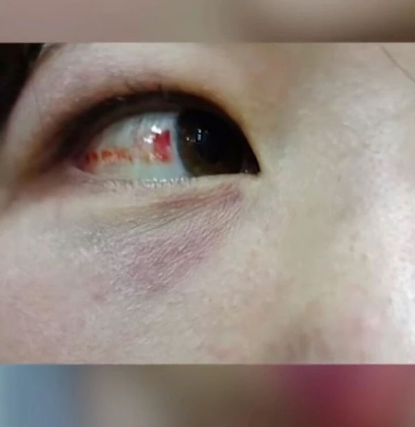 Người cha treo thưởng 34 triệu đồng cho ai tìm được kẻ đánh đập con mình-2