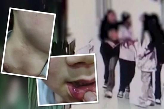 Người cha treo thưởng 34 triệu đồng cho ai tìm được kẻ đánh đập con mình