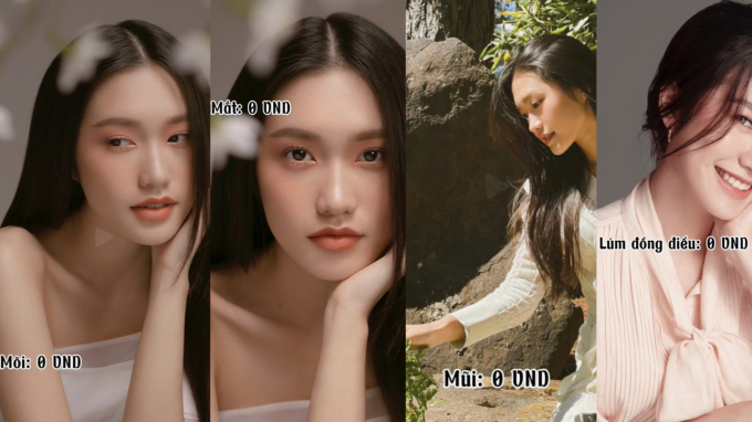 Vợ Đoàn Văn Hậu tự bóc cái giá cho nhan sắc xinh đẹp: Tốn bao nhiêu tiền thẩm mỹ?-1