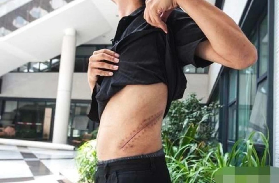 Nam sinh bán thận mua iPhone năm ấy hiện có cuộc sống bi thảm, giá ngày xưa bố mẹ dạy dỗ tốt-1