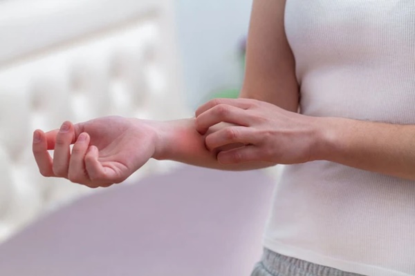 Từ ngứa đến ung thư gan giai đoạn cuối chỉ trong 3 tháng, 4 bất thường trên da xuất hiện cần đặc biệt đề phòng-5