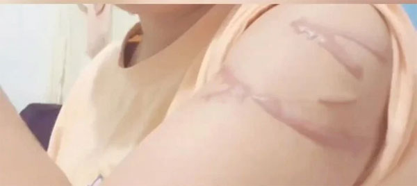 Chịu 20 nhát chém để cứu bạn cùng phòng, cô gái đau buồn trước sự vô ơn của bạn-1