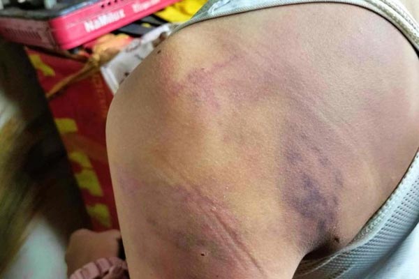 Mẹ của học sinh lớp 7 bị bạn đánh hội đồng xác định con tâm thần vĩnh viễn-5