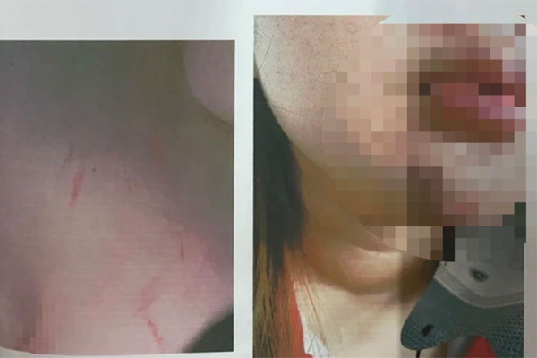 TPHCM: Xác minh thông tin nữ sinh lớp 12 kêu cứu vì bị phụ huynh của bạn đánh hội đồng-4
