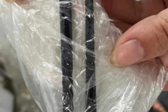 Người đàn ông không biết bị đôi đũa đâm xuyên sọ não suốt 5 tháng