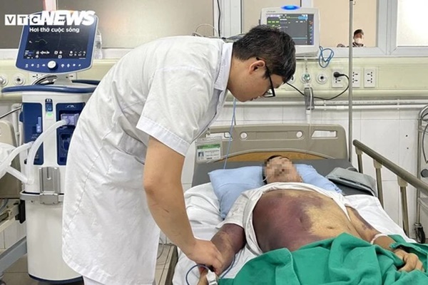 Tím đen toàn thân, gia đình phải xin đưa về sau 2 tuần điều trị sốt xuất huyết-1