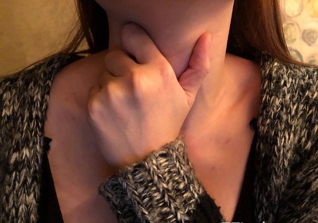 5 thói quen ăn uống tiếp tay cho bệnh ung thư thực quản, phổ biến nhất là cái đầu tiên-1