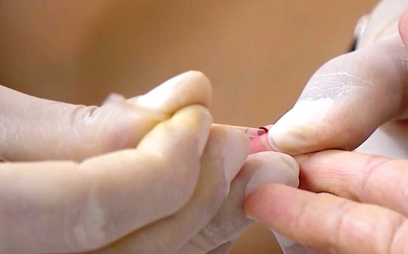 Số ca nhiễm HIV mới phát hiện tại Hà Nội tăng-1