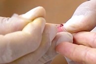 Số ca nhiễm HIV mới phát hiện tại Hà Nội tăng