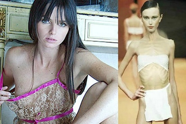 Lý do diễn viên múa đột ngột qua đời ở tuổi 21 gây sốc-3