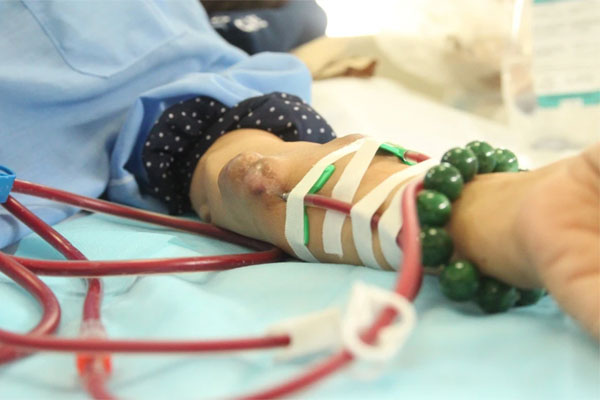 Nguyên nhân gây mờ mắt và đau đầu đột ngột, số 2 còn đe dọa tới tính mạng-5